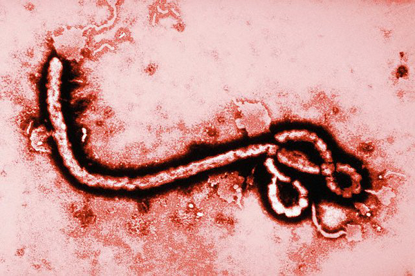  Знаем ли мы правду про вирус Эбола?