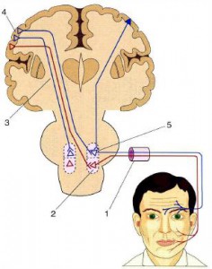  Лицевой нерв человека может стать парализованным из за мигрени