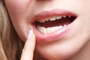  Распространенные заболевания полости рта