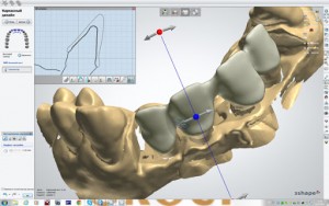  Преимущества использования CAD/CAM систем в стоматологии