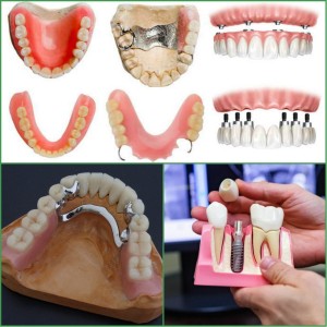  Протезирование передних зубов