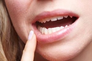 Распространенные заболевания полости рта