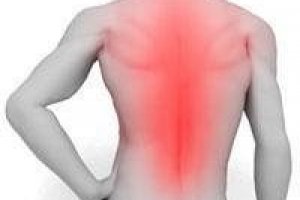 Лечение острой боли в области спины