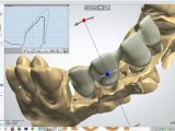 Преимущества использования CAD/CAM систем в стоматологии