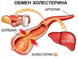 Медики говорят, что холестерин надо снижать, кушая авокадо