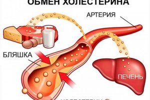 Медики говорят, что холестерин надо снижать, кушая авокадо